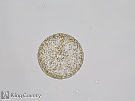 Photo of Coscinodiscus spp.